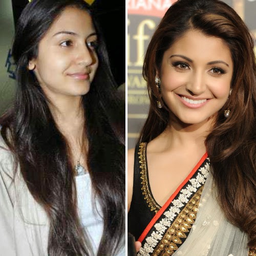 ANUSHKA SHARMA WITHOUT MAKEUP