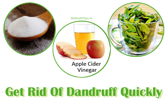 Herbal Home Remedies For Dandruff